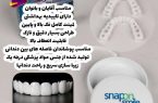 کلاهبرداری لمینت دندان مدل Bigsmile: